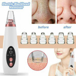 Vacuum Cleaner Blackhead Remover Black Dot Machine Skin Pore Suction Extractor Nose Cleansing Face Acne Black Head Clean Point